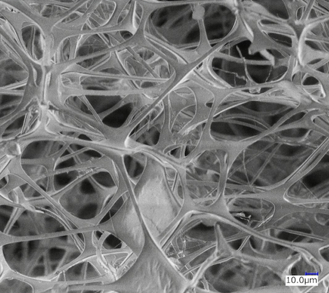 細かい網の目構造